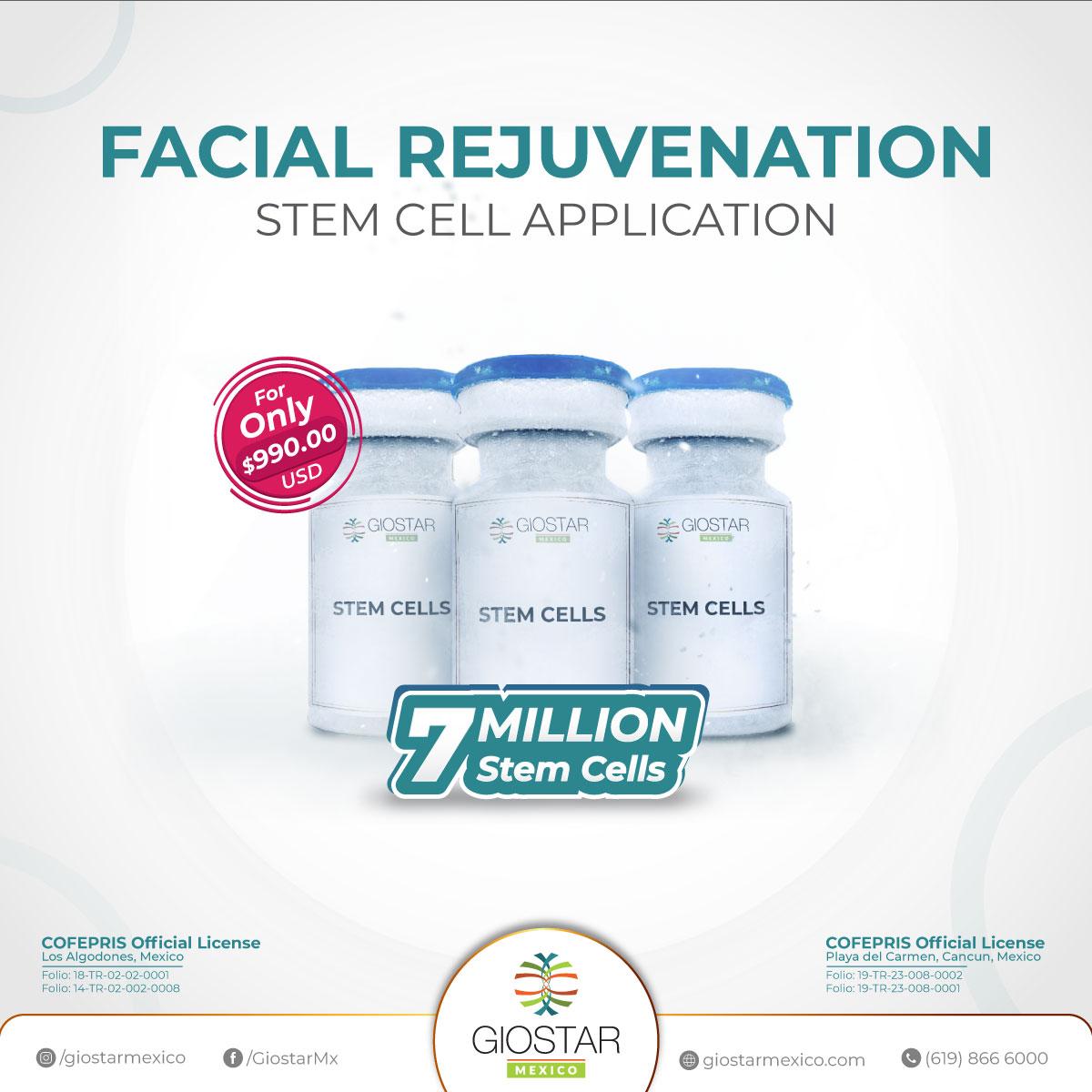 Facial Rejuvenation at Giostar Mexico Stem Cell Therapy