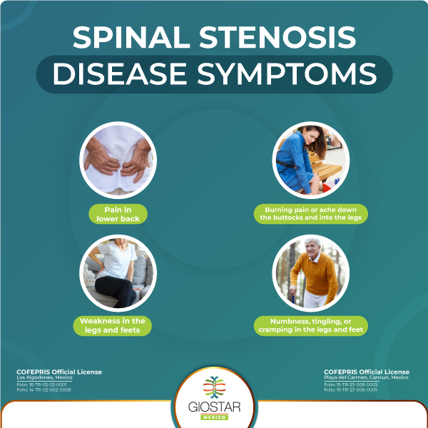Symptoms of spinal stenosis Listing of symptoms that may be caused by spinal stenosis