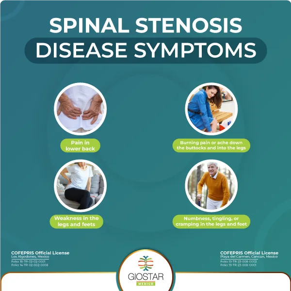 Listing of symptoms that may be caused by spinal stenosis