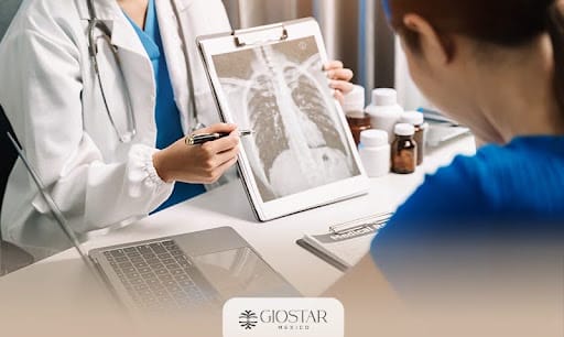 giostar-blog-2